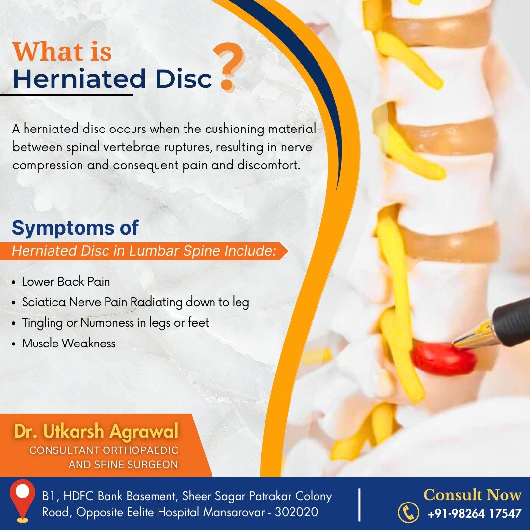 What is Herniated Disc