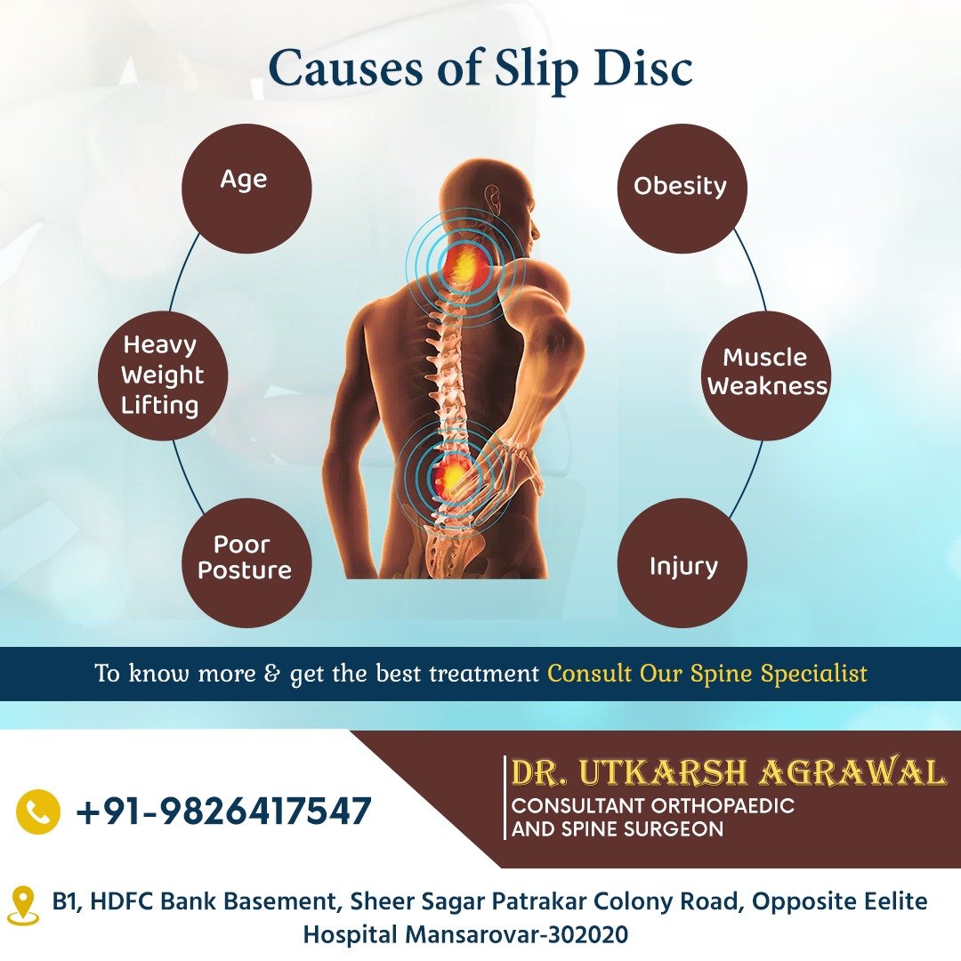 What Are the Causes of Slipped Disc? Explained by Dr. Utkarsh Agrawal