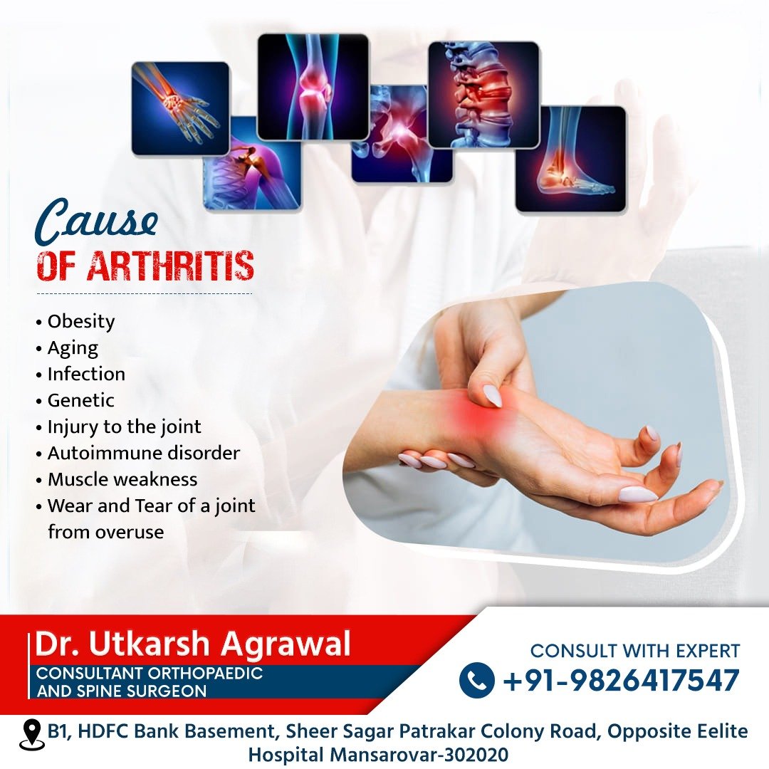 Understanding the Causes of Arthritis – Expert Insights by Dr. Utkarsh Agrawal