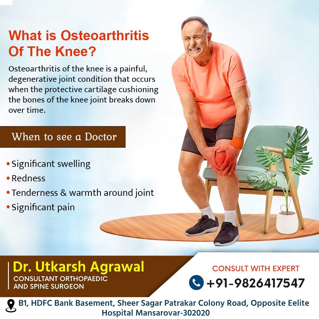What is Osteoarthritis of the Knee?