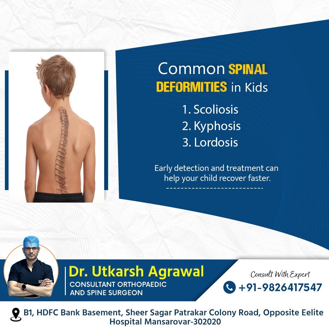 Common Spinal Deformities in Children: Early Detection Matters