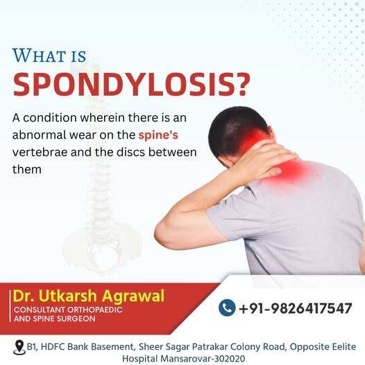 What is Spondylosis ? Spine Specialist in Mansarovar