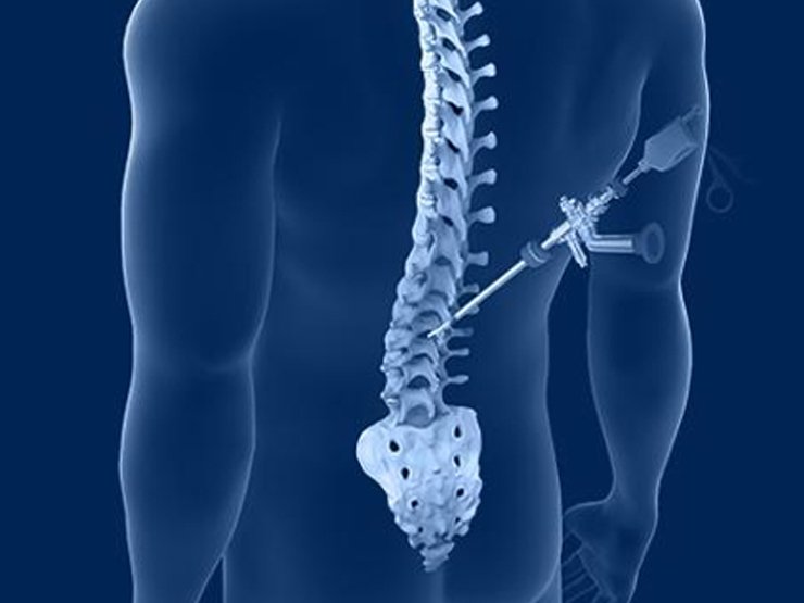 Best Spine Surgeon in Jaipur - Dr. Utkarsh Agrawal