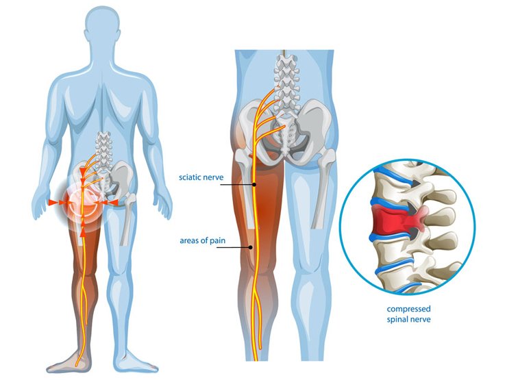 Best Spine Surgeon in Jaipur - Dr. Utkarsh Agrawal